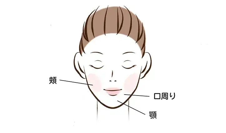 乾燥肌のニキビが発生しやすい場所