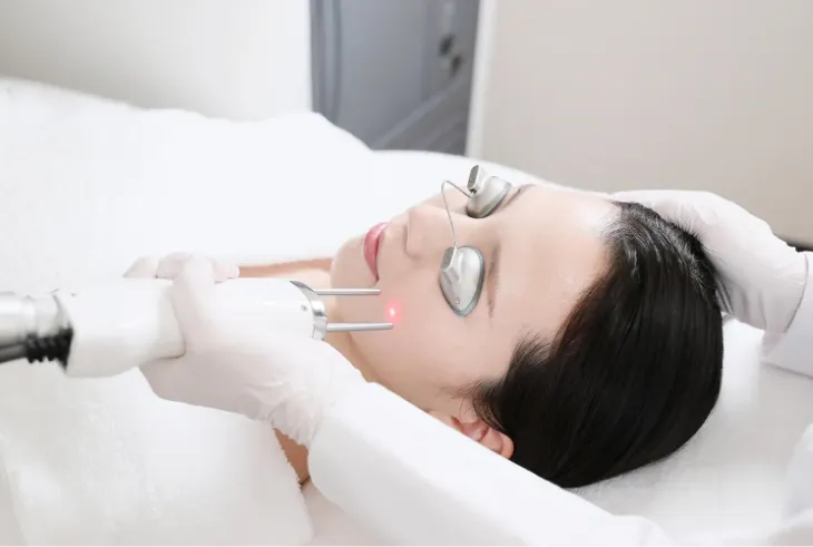 そばかすにおすすめのクリニックでの施術