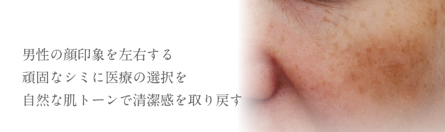 男性の顔印象を左右する頑固なシミに医療の選択を自然な肌トーンで清潔感を取り戻す
