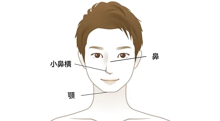 毛穴が目立ちやすい場所