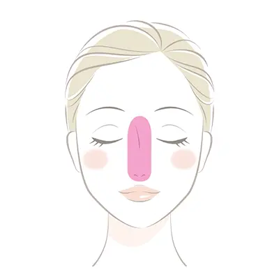 鼻ニキビの症状