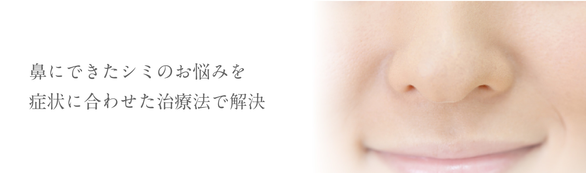 鼻にできたシミのお悩みを症状に合わせた治療法で解決