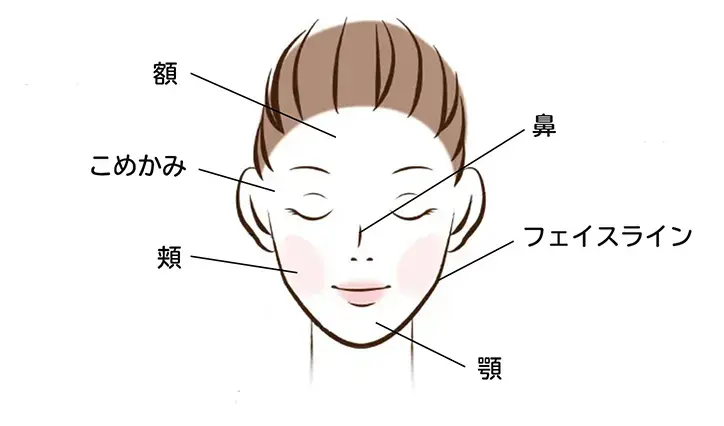 脂性肌のニキビが発生しやすい場所
