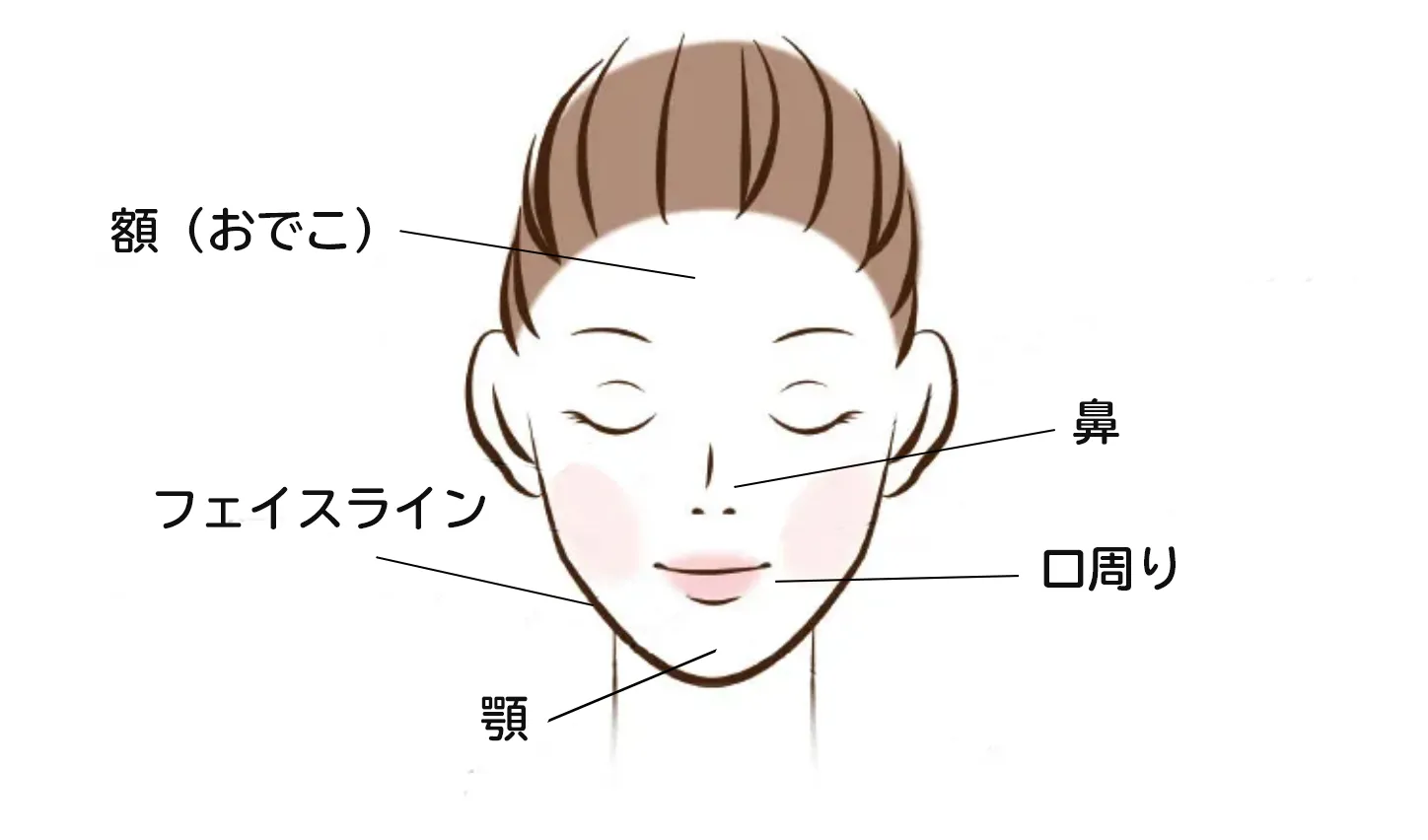 妊娠中にニキビが発生しやすい場所