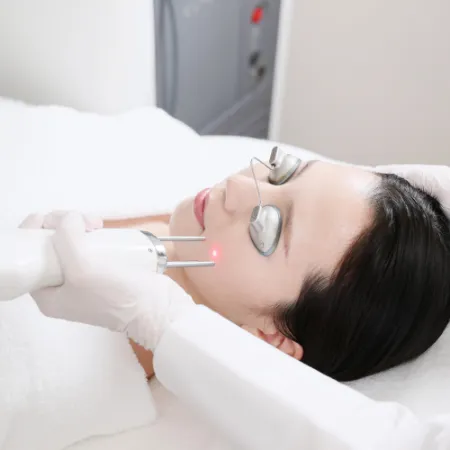 ピコレーザー（エンライトンSR）