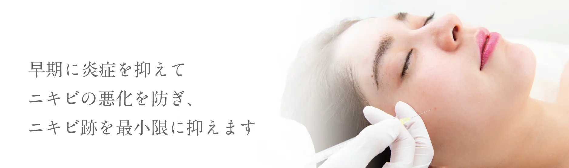 早期に炎症を抑えてニキビの悪化を防ぎ、ニキビ跡を最小限に抑えます