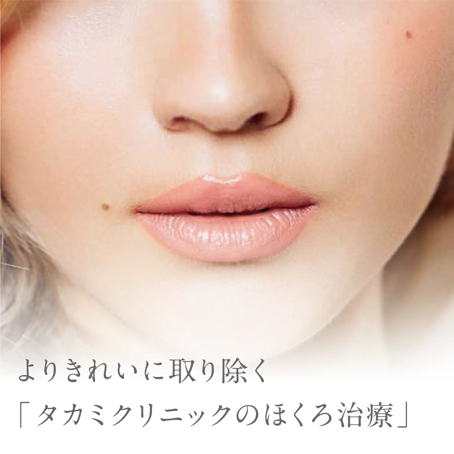 肌に跡を残さない「タカミクリニックのほくろ治療」