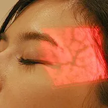 静脈可視化装置