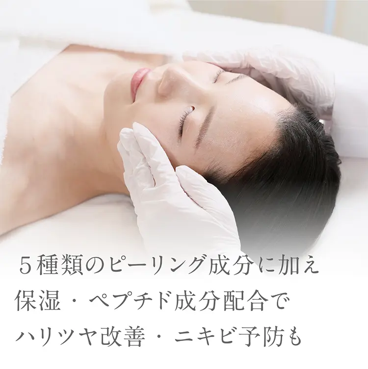 ペパーミントピール